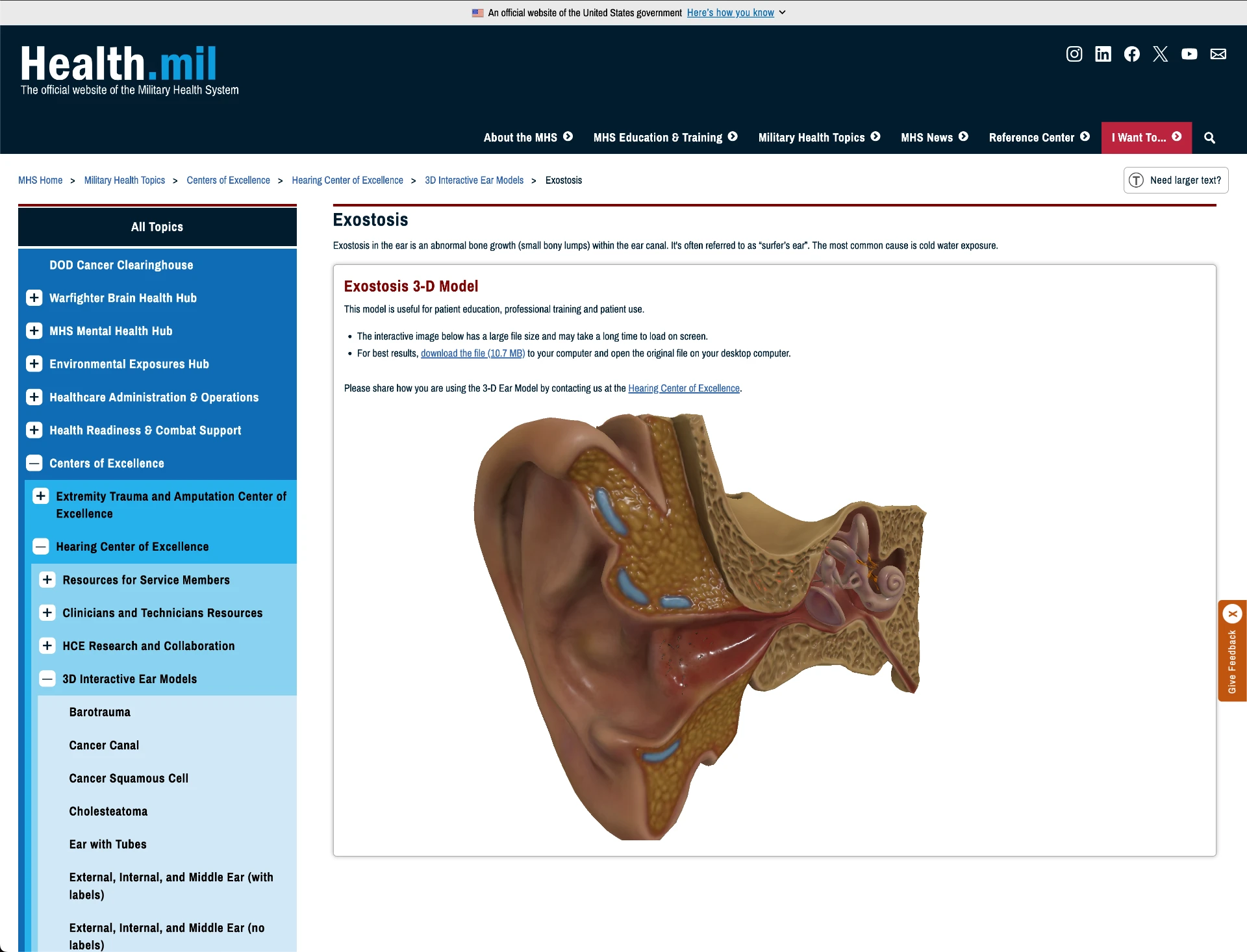 Health.mil Exostosis page showing an interactive 3-D model of the ear with surrounding page content and navigation.